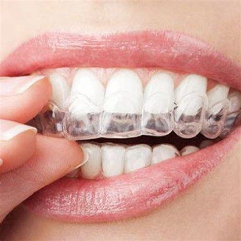 A Magical Solution for Crooked Teeth: The Power of Braces
